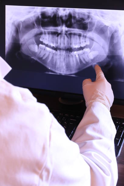 Best Emergency Root Canal Treatment in Superior, AZ